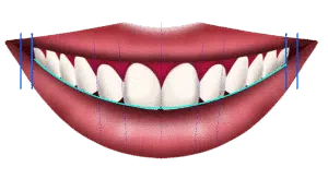 What is a perfect smile? The society’s POV